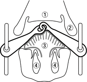 enkelgebroken bit